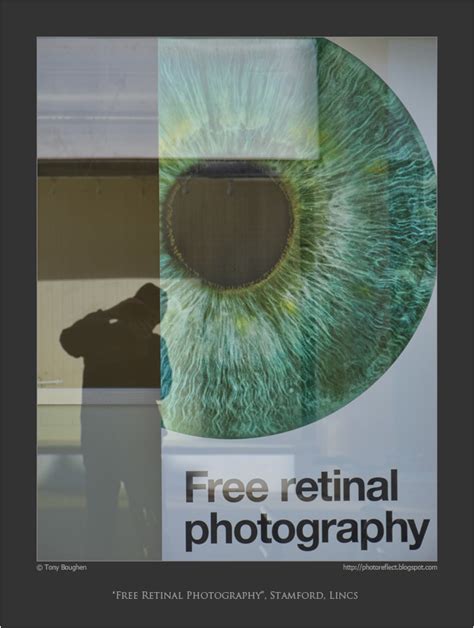 Free retinal photography .